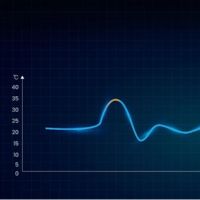 Revopoint Trackit technology