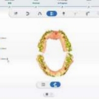 Analyse occlusale et vues en coupe