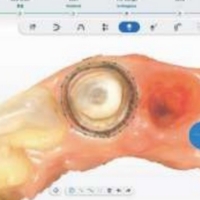 Extraction automatique des lignes de marge