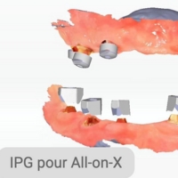 Numérisation assistée par IA