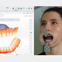 MetiSmile-MR trackers en markers