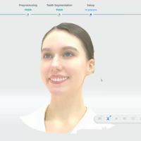 MetiSmile gezichts- en orthodontische analyse